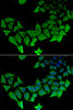 Immunofluorescence analysis of HeLa cells using APLP1 antibody (22-518) . Blue: DAPI for nuclear staining.