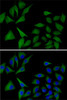 Immunofluorescence analysis of MCF7 cells using ATOX1 antibody (22-522) . Blue: DAPI for nuclear staining.