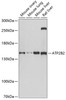 Western blot analysis of extracts of various cell lines, using ATP2B2 antibody (22-523) at 1:1000 dilution.<br/>Secondary antibody: HRP Goat Anti-Rabbit IgG (H+L) at 1:10000 dilution.<br/>Lysates/proteins: 25ug per lane.<br/>Blocking buffer: 3% nonfat dry milk in TBST.<br/>Detection: ECL Basic Kit.<br/>Exposure time: 10s.