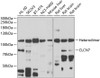 Western blot analysis of extracts of various cell lines, using CLCN7 antibody (22-531) at 1:1000 dilution._Secondary antibody: HRP Goat Anti-Rabbit IgG (H+L) at 1:10000 dilution._Lysates/proteins: 25ug per lane._Blocking buffer: 3% nonfat dry milk in TBST._Detection: ECL Enhanced Kit._Exposure time: 90s.