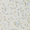 Immunohistochemistry of paraffin-embedded mouse brain using CLCN7 antibody (22-531) at dilution of 1:100 (40x lens) .