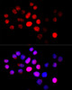 Immunofluorescence analysis of HeLa cells using CYP4B1 antibody (22-535) at dilution of 1:100 (40x lens) . Blue: DAPI for nuclear staining.