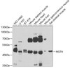 Western blot analysis of extracts of various cell lines, using MSTN antibody (22-550) at 1:1000 dilution.<br/>Secondary antibody: HRP Goat Anti-Rabbit IgG (H+L) at 1:10000 dilution.<br/>Lysates/proteins: 25ug per lane.<br/>Blocking buffer: 3% nonfat dry milk in TBST.<br/>Detection: ECL Basic Kit.<br/>Exposure time: 90s.