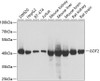 Western blot analysis of extracts of various cell lines, using GOT2 antibody (22-551) at 1:1000 dilution.<br/>Secondary antibody: HRP Goat Anti-Rabbit IgG (H+L) at 1:10000 dilution.<br/>Lysates/proteins: 25ug per lane.<br/>Blocking buffer: 3% nonfat dry milk in TBST.<br/>Detection: ECL Basic Kit.<br/>Exposure time: 5s.