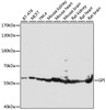 Immunohistochemistry of paraffin-embedded human lung using GPI antibody (22-552) at dilution of 1:100 (40x lens) .