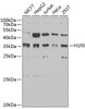 Western blot analysis of extracts of various cell lines, using Histone H1.0 antibody (22-554) at 1:1000 dilution.<br/>Secondary antibody: HRP Goat Anti-Rabbit IgG (H+L) at 1:10000 dilution.<br/>Lysates/proteins: 25ug per lane.<br/>Blocking buffer: 3% nonfat dry milk in TBST.<br/>Detection: ECL Basic Kit.<br/>Exposure time: 90s.