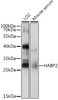 Western blot analysis of extracts of various cell lines, using HABP2 antibody (22-555) at 1:1000 dilution.<br/>Secondary antibody: HRP Goat Anti-Rabbit IgG (H+L) at 1:10000 dilution.<br/>Lysates/proteins: 25ug per lane.<br/>Blocking buffer: 3% nonfat dry milk in TBST.<br/>Detection: ECL Basic Kit.<br/>Exposure time: 15s.