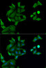 Immunofluorescence analysis of MCF7 cells using HABP2 antibody (22-555) . Blue: DAPI for nuclear staining.