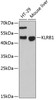 Western blot analysis of extracts of various cell lines, using KLRB1 antibody (22-562) at 1:3000 dilution._Secondary antibody: HRP Goat Anti-Rabbit IgG (H+L) at 1:10000 dilution._Lysates/proteins: 25ug per lane._Blocking buffer: 3% nonfat dry milk in TBST._Detection: ECL Enhanced Kit._Exposure time: 90s.