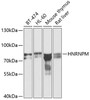 Western blot analysis of extracts of various cell lines, using HNRNPM antibody (22-568) at 1:1000 dilution.<br/>Secondary antibody: HRP Goat Anti-Rabbit IgG (H+L) at 1:10000 dilution.<br/>Lysates/proteins: 25ug per lane.<br/>Blocking buffer: 3% nonfat dry milk in TBST.<br/>Detection: ECL Basic Kit.<br/>Exposure time: 60s.