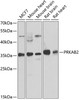 Western blot analysis of extracts of various cell lines, using PRKAB2 antibody (22-582) at 1:1000 dilution.<br/>Secondary antibody: HRP Goat Anti-Rabbit IgG (H+L) at 1:10000 dilution.<br/>Lysates/proteins: 25ug per lane.<br/>Blocking buffer: 3% nonfat dry milk in TBST.<br/>Detection: ECL Basic Kit.<br/>Exposure time: 90s.