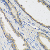 Immunohistochemistry of paraffin-embedded human prostate using RAD51C antibody (22-588) at dilution of 1:100 (40x lens) .