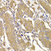 Immunohistochemistry of paraffin-embedded human stomach using RASGRF1 antibody (22-591) at dilution of 1:100 (40x lens) .