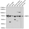 Western blot analysis of extracts of various cell lines, using RBBP5 antibody (22-592) at 1:1000 dilution.<br/>Secondary antibody: HRP Goat Anti-Rabbit IgG (H+L) at 1:10000 dilution.<br/>Lysates/proteins: 25ug per lane.<br/>Blocking buffer: 3% nonfat dry milk in TBST.<br/>Detection: ECL Basic Kit.<br/>Exposure time: 10s.