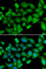 Immunofluorescence analysis of MCF-7 cells using RBBP7 antibody (22-594) . Blue: DAPI for nuclear staining.