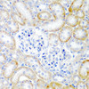 Immunohistochemistry of paraffin-embedded rat kidney using RLN2 antibody (22-595) at dilution of 1:200 (40x lens) .