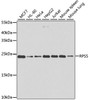 Western blot analysis of extracts of various cell lines, using RPS5 antibody (22-598) at 1:1000 dilution.<br/>Secondary antibody: HRP Goat Anti-Rabbit IgG (H+L) at 1:10000 dilution.<br/>Lysates/proteins: 25ug per lane.<br/>Blocking buffer: 3% nonfat dry milk in TBST.<br/>Detection: ECL Basic Kit.<br/>Exposure time: 30s.
