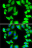 Immunofluorescence analysis of MCF7 cells using RPS5 antibody (22-598) . Blue: DAPI for nuclear staining.