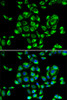 Immunofluorescence analysis of U2OS cells using RPS16 antibody (22-599) . Blue: DAPI for nuclear staining.