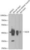 Western blot analysis of extracts of various cell lines, using SGCB antibody (22-602) at 1:1000 dilution.<br/>Secondary antibody: HRP Goat Anti-Rabbit IgG (H+L) at 1:10000 dilution.<br/>Lysates/proteins: 25ug per lane.<br/>Blocking buffer: 3% nonfat dry milk in TBST.<br/>Detection: ECL Basic Kit.<br/>Exposure time: 90s.