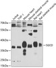 Western blot analysis of extracts of various cell lines, using SGCD antibody (22-603) at 1:1000 dilution.<br/>Secondary antibody: HRP Goat Anti-Rabbit IgG (H+L) at 1:10000 dilution.<br/>Lysates/proteins: 25ug per lane.<br/>Blocking buffer: 3% nonfat dry milk in TBST.<br/>Detection: ECL Basic Kit.<br/>Exposure time: 90s.