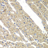 Immunohistochemistry of paraffin-embedded rat heart using SGCD antibody (22-603) at dilution of 1:100 (40x lens) .