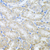 Immunohistochemistry of paraffin-embedded mouse kidney using TARS antibody (22-615) at dilution of 1:100 (40x lens) .