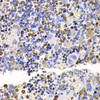 Immunohistochemistry of paraffin-embedded rat spleen using UBE2V2 antibody (22-619) at dilution of 1:100 (40x lens) .