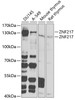 Western blot analysis of extracts of various cell lines, using ZNF217 Antibody (22-623) at 1:1000 dilution.<br/>Secondary antibody: HRP Goat Anti-Rabbit IgG (H+L) at 1:10000 dilution.<br/>Lysates/proteins: 25ug per lane.<br/>Blocking buffer: 3% nonfat dry milk in TBST.<br/>Detection: ECL Basic Kit.<br/>Exposure time: 90s.