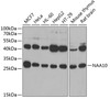 Western blot analysis of extracts of various cell lines, using NAA10 antibody (22-628) at 1:1000 dilution.<br/>Secondary antibody: HRP Goat Anti-Rabbit IgG (H+L) at 1:10000 dilution.<br/>Lysates/proteins: 25ug per lane.<br/>Blocking buffer: 3% nonfat dry milk in TBST.<br/>Detection: ECL Basic Kit.<br/>Exposure time: 10s.