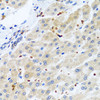 Immunohistochemistry of paraffin-embedded human liver using RGS5 antibody (22-632) at dilution of 1:100 (40x lens) .