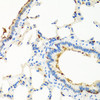 Immunohistochemistry of paraffin-embedded rat lung using RGS5 antibody (22-632) at dilution of 1:100 (40x lens) .