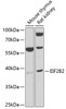 Western blot analysis of extracts of various cell lines, using EIF2B2 antibody (22-641) at 1:1000 dilution.<br/>Secondary antibody: HRP Goat Anti-Rabbit IgG (H+L) at 1:10000 dilution.<br/>Lysates/proteins: 25ug per lane.<br/>Blocking buffer: 3% nonfat dry milk in TBST.<br/>Detection: ECL Basic Kit.<br/>Exposure time: 10s.