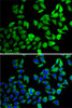 Immunofluorescence analysis of A-549 cells using USP8 antibody (22-643) . Blue: DAPI for nuclear staining.