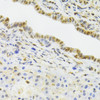 Immunohistochemistry of paraffin-embedded rat liver using EFTUD2 Antibody (22-651) at dilution of 1:100 (40x lens) .