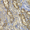 Immunohistochemistry of paraffin-embedded mouse kidney using NMT2 antibody (22-653) at dilution of 1:100 (40x lens) .
