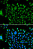 Immunofluorescence analysis of U2OS cells using NCOR1 antibody (22-657) . Blue: DAPI for nuclear staining.