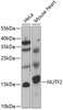 Western blot analysis of extracts of various cell lines, using NUTF2 antibody (22-665) at 1:1000 dilution.<br/>Secondary antibody: HRP Goat Anti-Rabbit IgG (H+L) at 1:10000 dilution.<br/>Lysates/proteins: 25ug per lane.<br/>Blocking buffer: 3% nonfat dry milk in TBST.<br/>Detection: ECL Basic Kit.<br/>Exposure time: 90s.