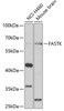 Western blot analysis of extracts of various cell lines, using FASTK antibody (22-673) at 1:1000 dilution.<br/>Secondary antibody: HRP Goat Anti-Rabbit IgG (H+L) at 1:10000 dilution.<br/>Lysates/proteins: 25ug per lane.<br/>Blocking buffer: 3% nonfat dry milk in TBST.<br/>Detection: ECL Basic Kit.<br/>Exposure time: 90s.