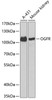 Western blot analysis of extracts of various cell lines, using OGFR antibody (22-678) at 1:1000 dilution.<br/>Secondary antibody: HRP Goat Anti-Rabbit IgG (H+L) at 1:10000 dilution.<br/>Lysates/proteins: 25ug per lane.<br/>Blocking buffer: 3% nonfat dry milk in TBST.<br/>Detection: ECL Basic Kit.<br/>Exposure time: 90s.