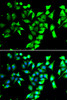 Immunofluorescence analysis of A549 cells using FKBP8 antibody (22-685) . Blue: DAPI for nuclear staining.