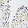 Immunohistochemistry of paraffin-embedded human lung using UPF2 antibody (22-689) at dilution of 1:100 (40x lens) .