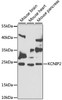 Western blot analysis of extracts of various cell lines, using KCNIP2 antibody (22-698) at 1:1000 dilution.<br/>Secondary antibody: HRP Goat Anti-Rabbit IgG (H+L) at 1:10000 dilution.<br/>Lysates/proteins: 25ug per lane.<br/>Blocking buffer: 3% nonfat dry milk in TBST.<br/>Detection: ECL Basic Kit.<br/>Exposure time: 90s.