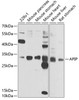 Western blot analysis of extracts of various cell lines, using APIP antibody (22-700) at 1:1000 dilution.<br/>Secondary antibody: HRP Goat Anti-Rabbit IgG (H+L) at 1:10000 dilution.<br/>Lysates/proteins: 25ug per lane.<br/>Blocking buffer: 3% nonfat dry milk in TBST.<br/>Detection: ECL Enhanced Kit.<br/>Exposure time: 10s.