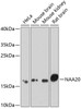 Western blot analysis of extracts of various cell lines, using NAA20 antibody (22-702) at 1:1000 dilution._Secondary antibody: HRP Goat Anti-Rabbit IgG (H+L) at 1:10000 dilution._Lysates/proteins: 25ug per lane._Blocking buffer: 3% nonfat dry milk in TBST._Detection: ECL Enhanced Kit._Exposure time: 90s.