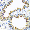 Immunohistochemistry of paraffin-embedded mouse lung using SERPINA10 antibody (22-703) at dilution of 1:100 (40x lens) .