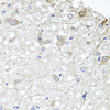 Immunohistochemistry of paraffin-embedded rat brain using METTL13 antibody (22-708) at dilution of 1:100 (40x lens) .