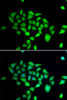 Immunofluorescence analysis of A549 cells using DPP8 antibody (22-710) . Blue: DAPI for nuclear staining.