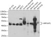 Western blot analysis of extracts of various cell lines, using ARFGAP1 antibody (22-715) at 1:1000 dilution.<br/>Secondary antibody: HRP Goat Anti-Rabbit IgG (H+L) at 1:10000 dilution.<br/>Lysates/proteins: 25ug per lane.<br/>Blocking buffer: 3% nonfat dry milk in TBST.<br/>Detection: ECL Basic Kit.<br/>Exposure time: 3s.