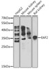 Western blot analysis of extracts of various cell lines, using EAF2 antibody (22-716) at 1:1000 dilution.<br/>Secondary antibody: HRP Goat Anti-Rabbit IgG (H+L) at 1:10000 dilution.<br/>Lysates/proteins: 25ug per lane.<br/>Blocking buffer: 3% nonfat dry milk in TBST.<br/>Detection: ECL Enhanced Kit.<br/>Exposure time: 90s.